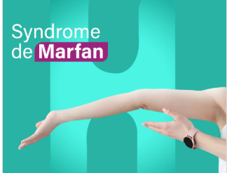 Maladie de Marfan Maladie de Marfan